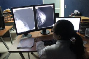 UNEME&ndash;DEDICAM, atenci&oacute;n integral&nbsp;para prevenir el c&aacute;ncer de mama