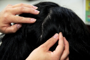 Panorama general de la pediculosis en Hidalgo