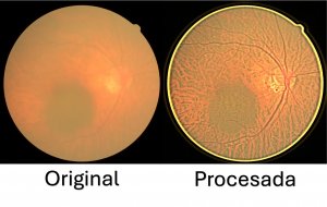 Desarrolla UPT sistema de bajo costo para mejorar im&aacute;genes de retina