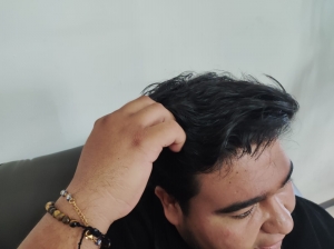 Por calor, SSH pide prevenir contagios por piojos en infancias&nbsp;